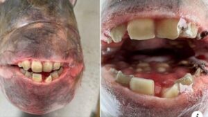 Un pescatore cattura uno strano pesce con denti simili a quelli umani e sua figlia vuole darli alla fatina dei denti